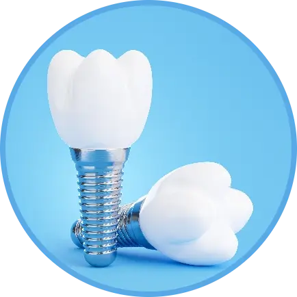 image of 2 dental implants