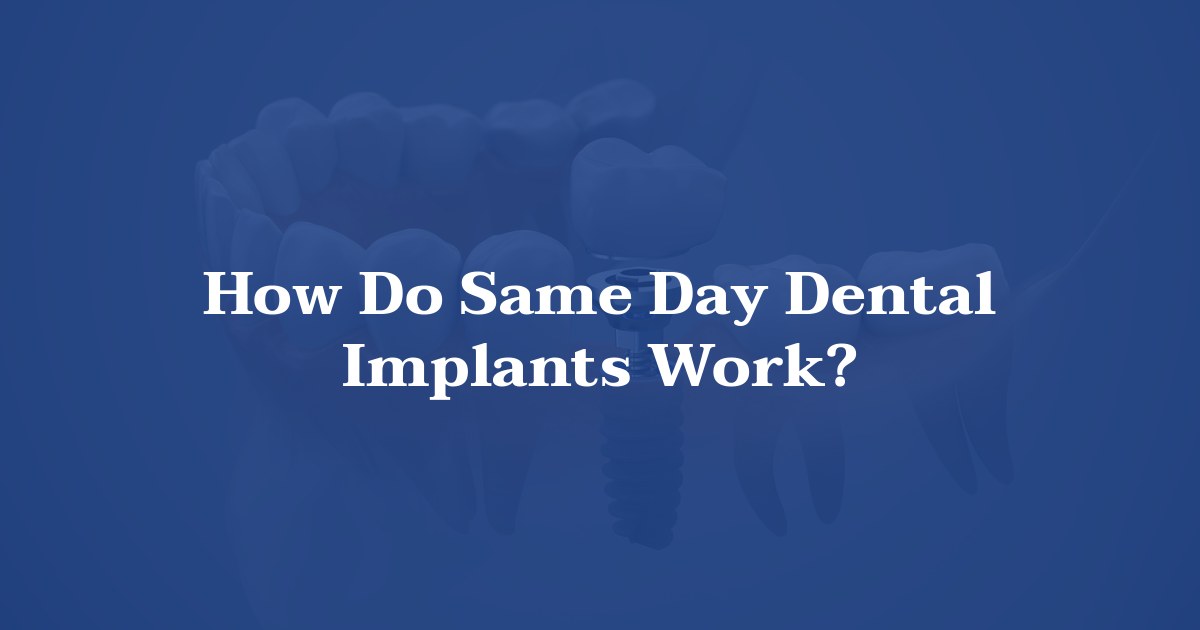 How Do Same Day Dental Implants Work? at Utah Facial & Oral Surgery